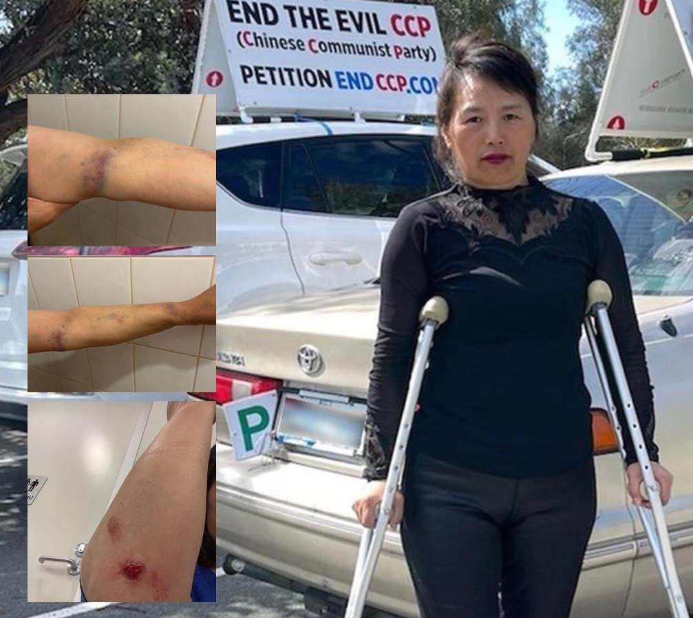 退<span style='max-width:0px!important;margin-left:-4px;color:#eee!important;'>!</span>党<span style='max-width:0px!important;margin-left:-4px;color:#eee!important;'>!</span>中心谴责亲共分子袭击澳洲End CCP义工 2 au2